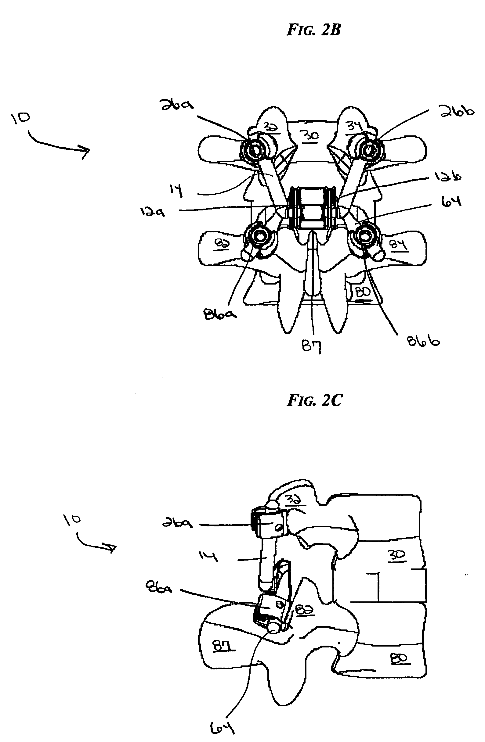 Non-linear artificial ligament system