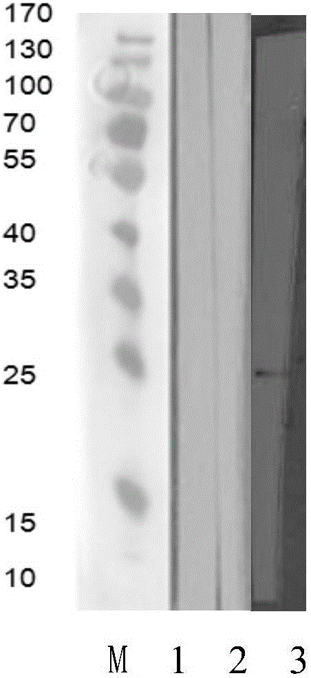 Monoclonal antibody and antibody combination for resisting foot-and-mouth disease type O virus and application thereof in detection of antigens and antibodies of virus