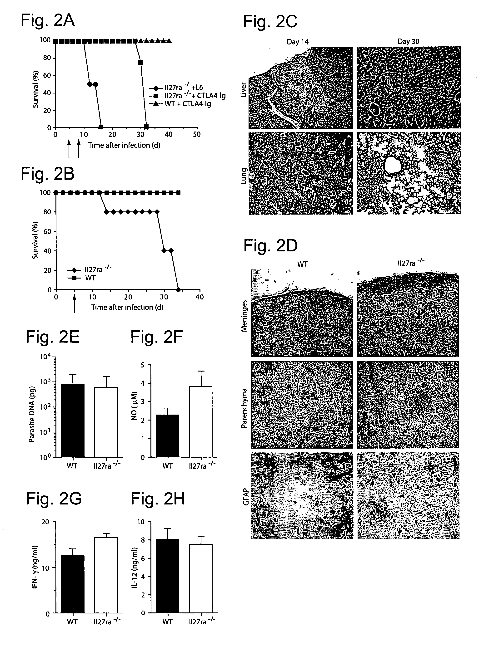 WSX-1/P28 as a target for anti-inflammatory responses