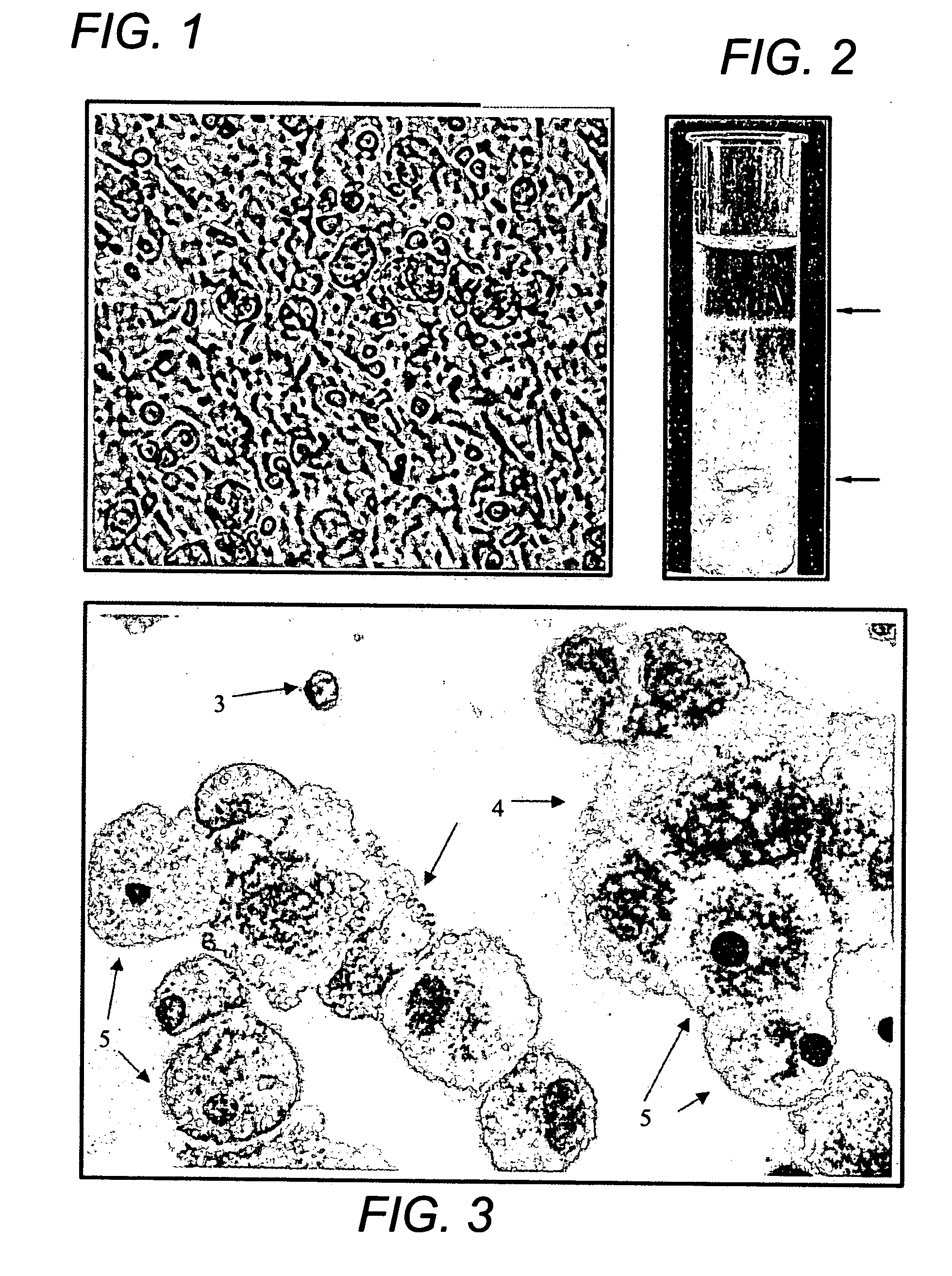 Human mesenchymal progenitor cell