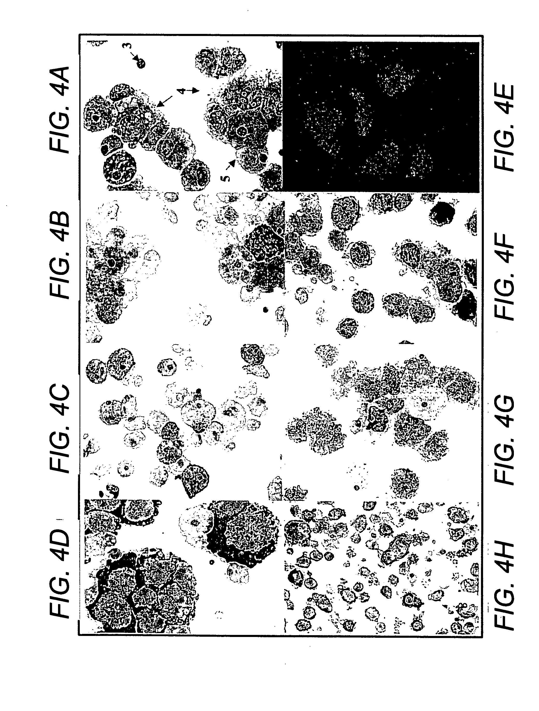 Human mesenchymal progenitor cell