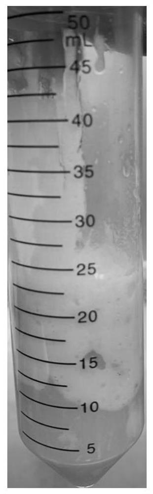 Preparation method of adipose tissue extracellular matrix