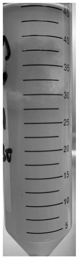 Preparation method of adipose tissue extracellular matrix