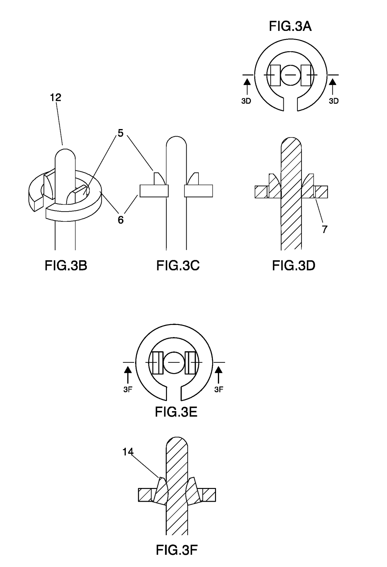 Catheter and guidewire advancement device