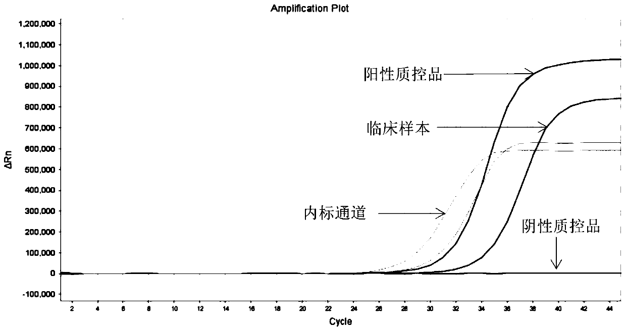 Kit and method for multiple detection of ROS1 fusion gene mutation