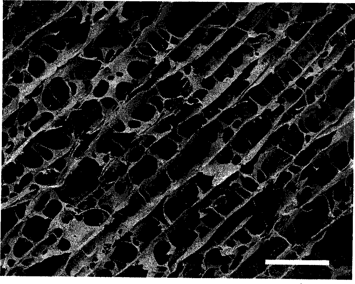 High-artificial tissue engineering nerve repair material NGCS and preparation method thereof