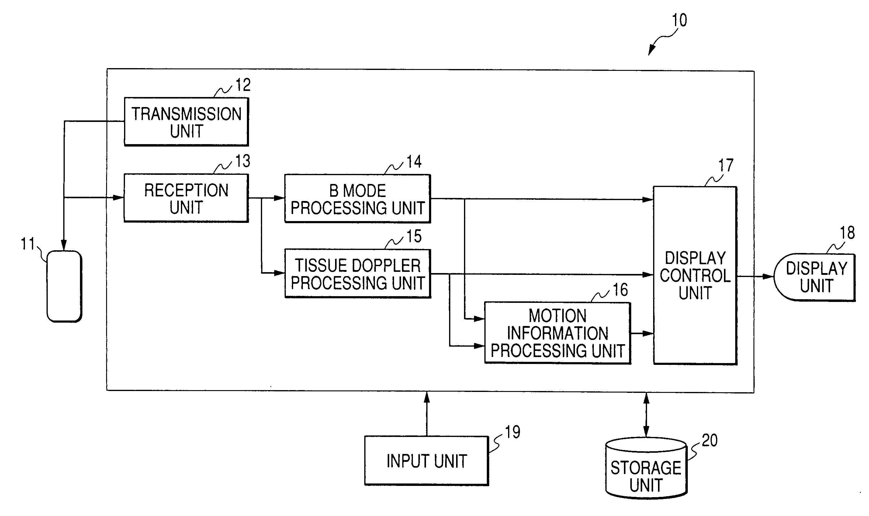 Ultrasonic image processor and ultrasonic diagnostic instrument