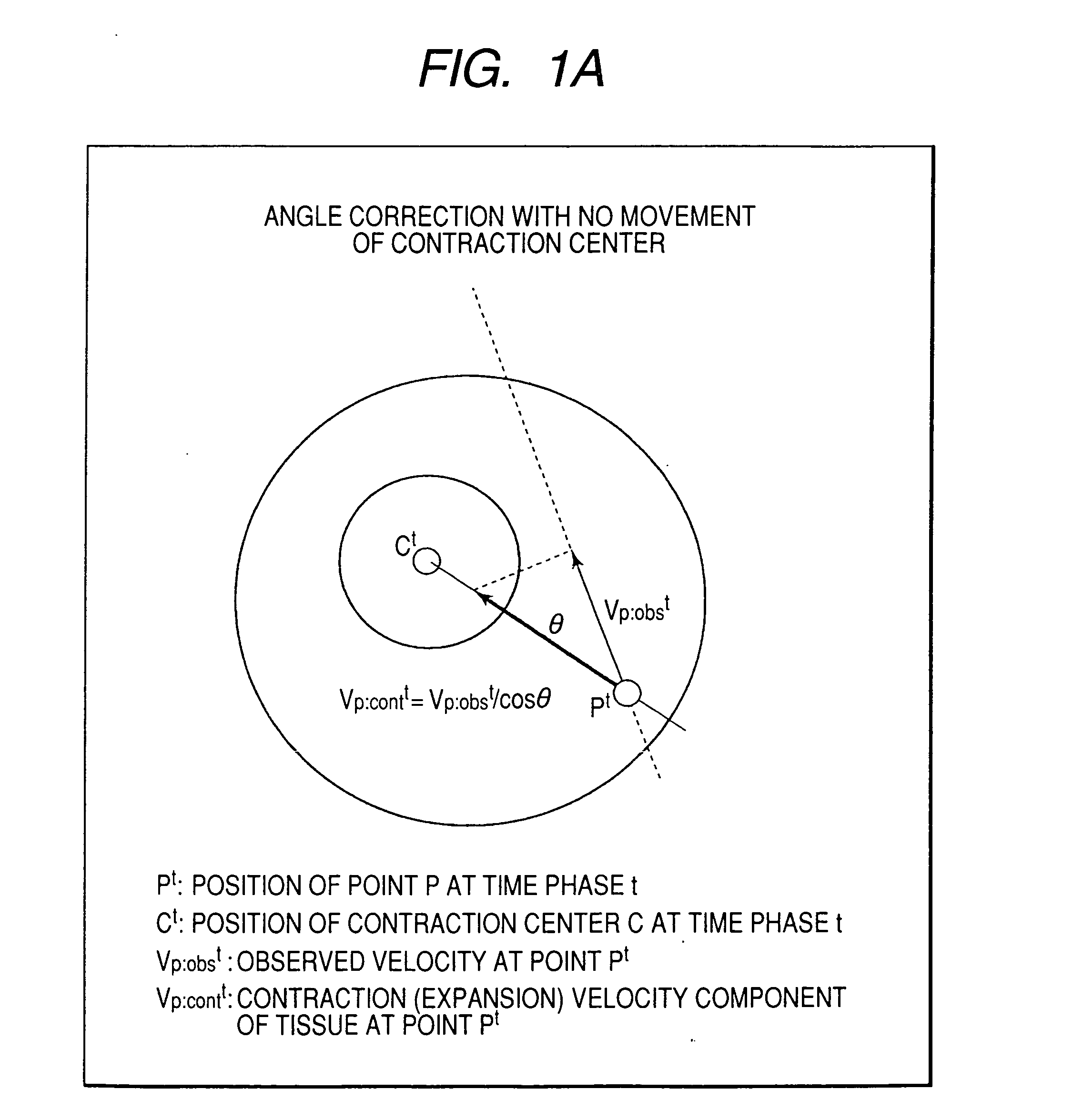 Ultrasonic image processor and ultrasonic diagnostic instrument