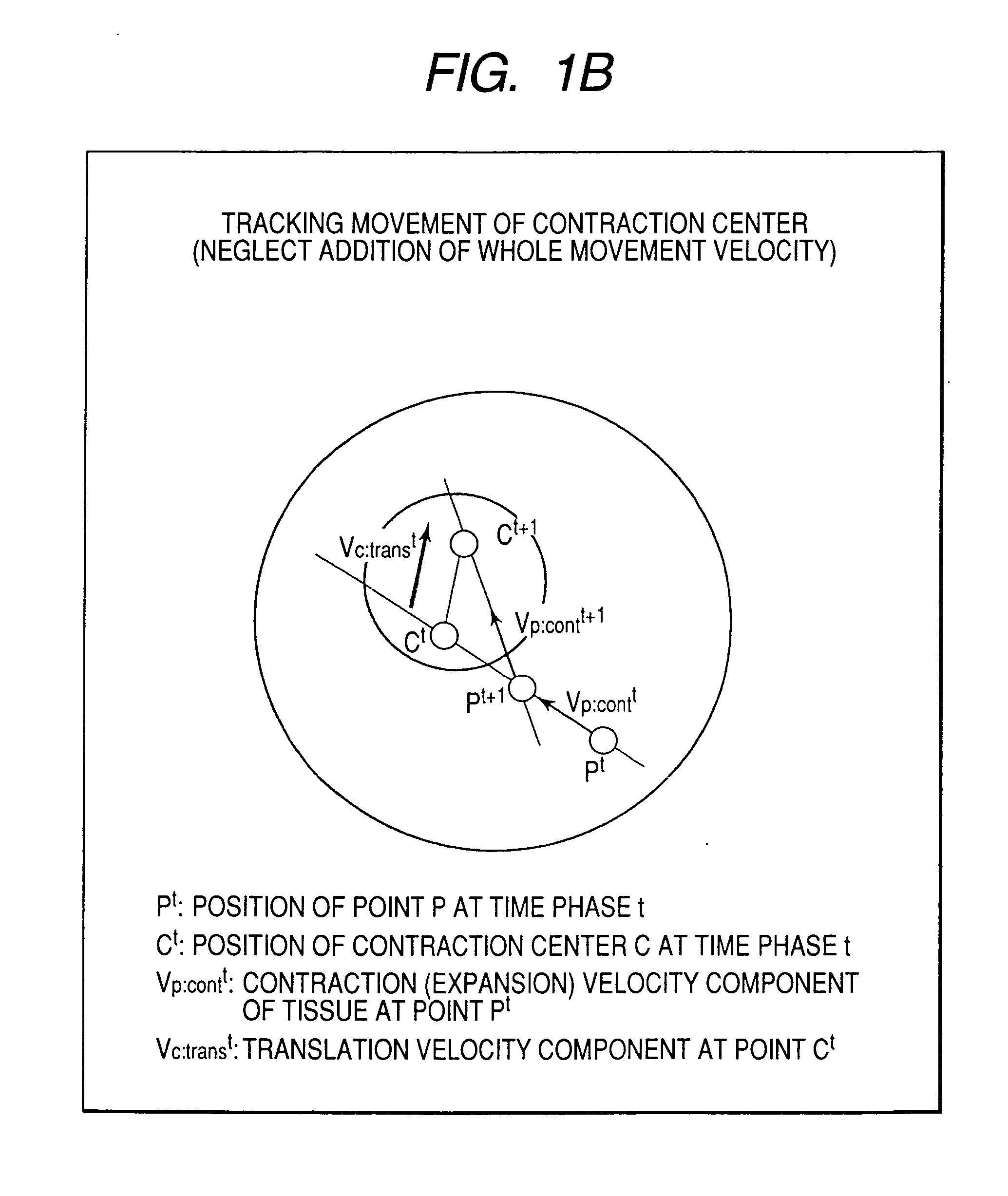 Ultrasonic image processor and ultrasonic diagnostic instrument