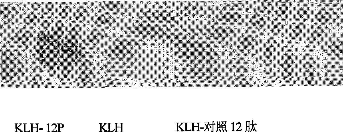 Vaccine based on simulating human blood vessel endothelial cell growth factor VEGF epitope and preparation method thereof