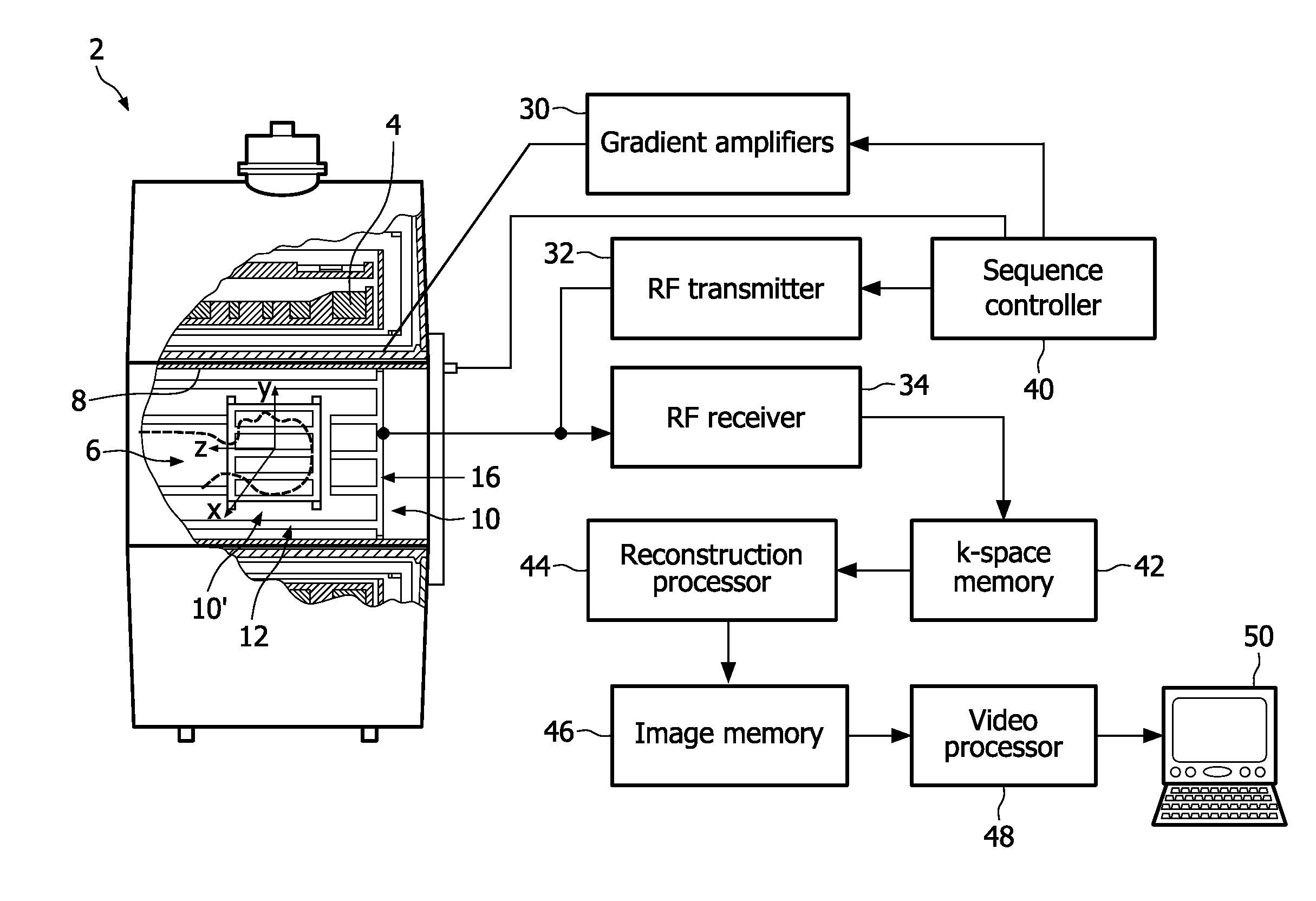 Birdcage coil with improved homogeneity and reduced SAR