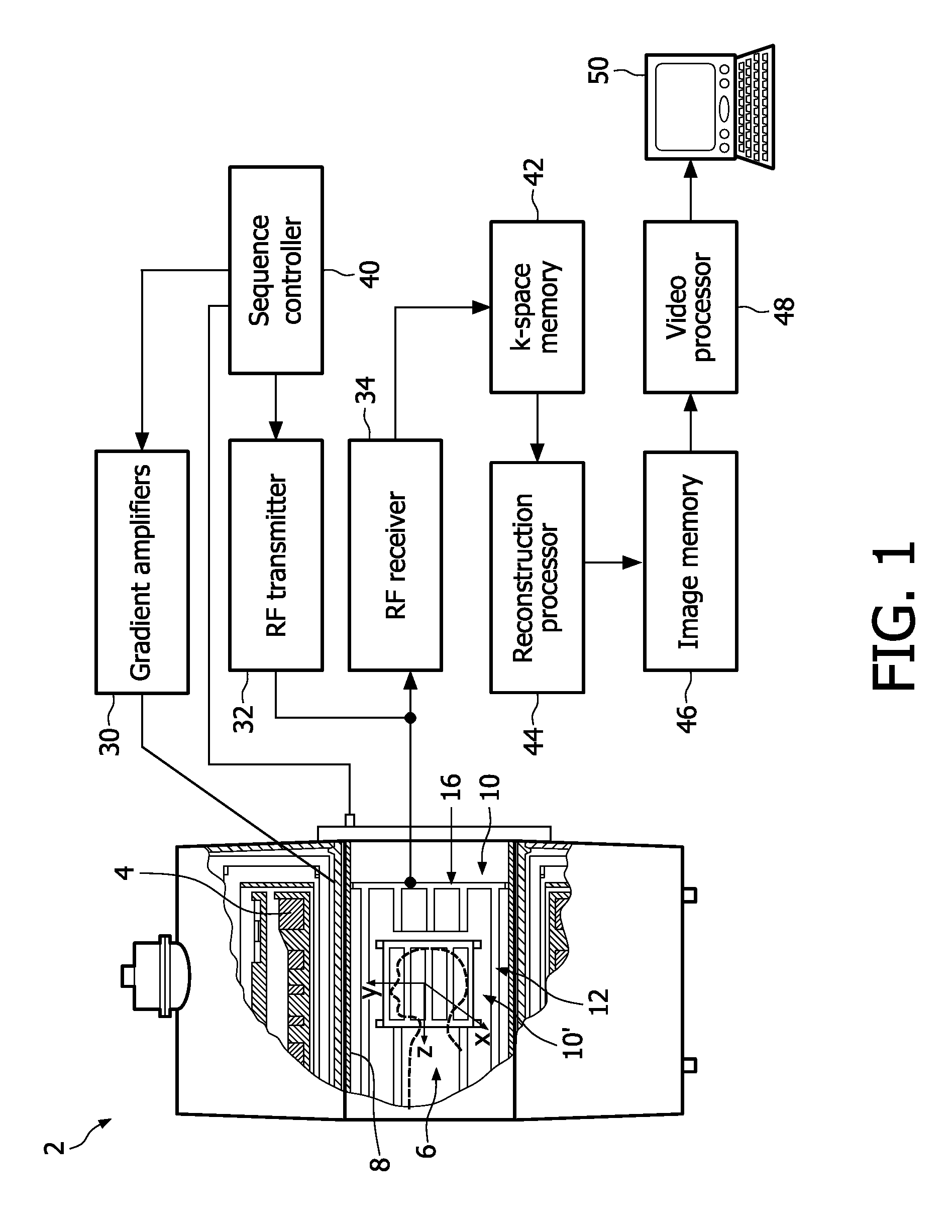 Birdcage coil with improved homogeneity and reduced SAR