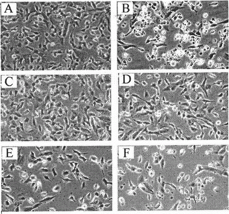 (E)-1-(3,5-dimethoxyphenyl)-2-(3,5-dihydroxy-4-methoxyphenyl)ethylene, and preparation method and application thereof