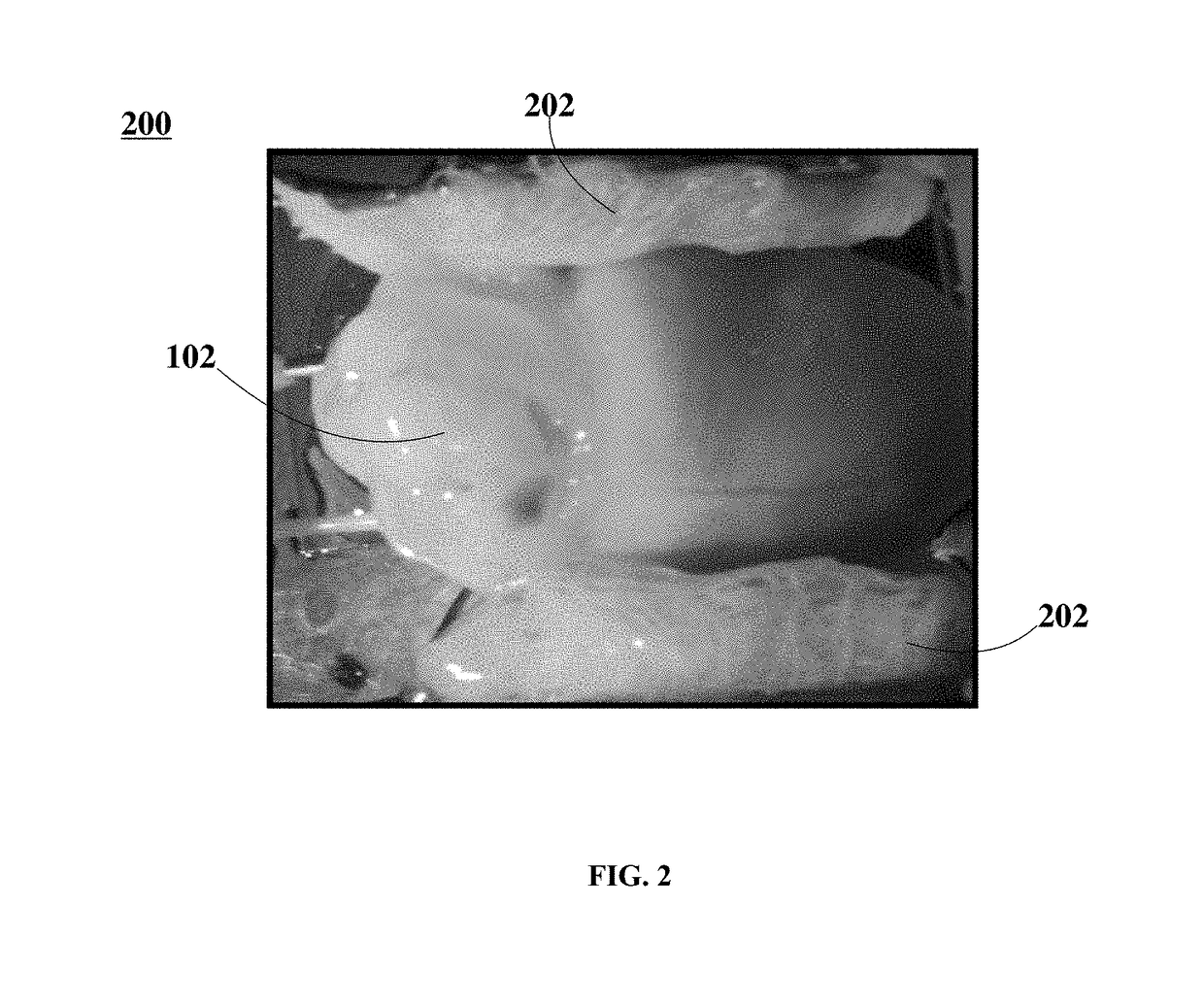 Low-energy defibrillation with nanosecond pulsed electric fields