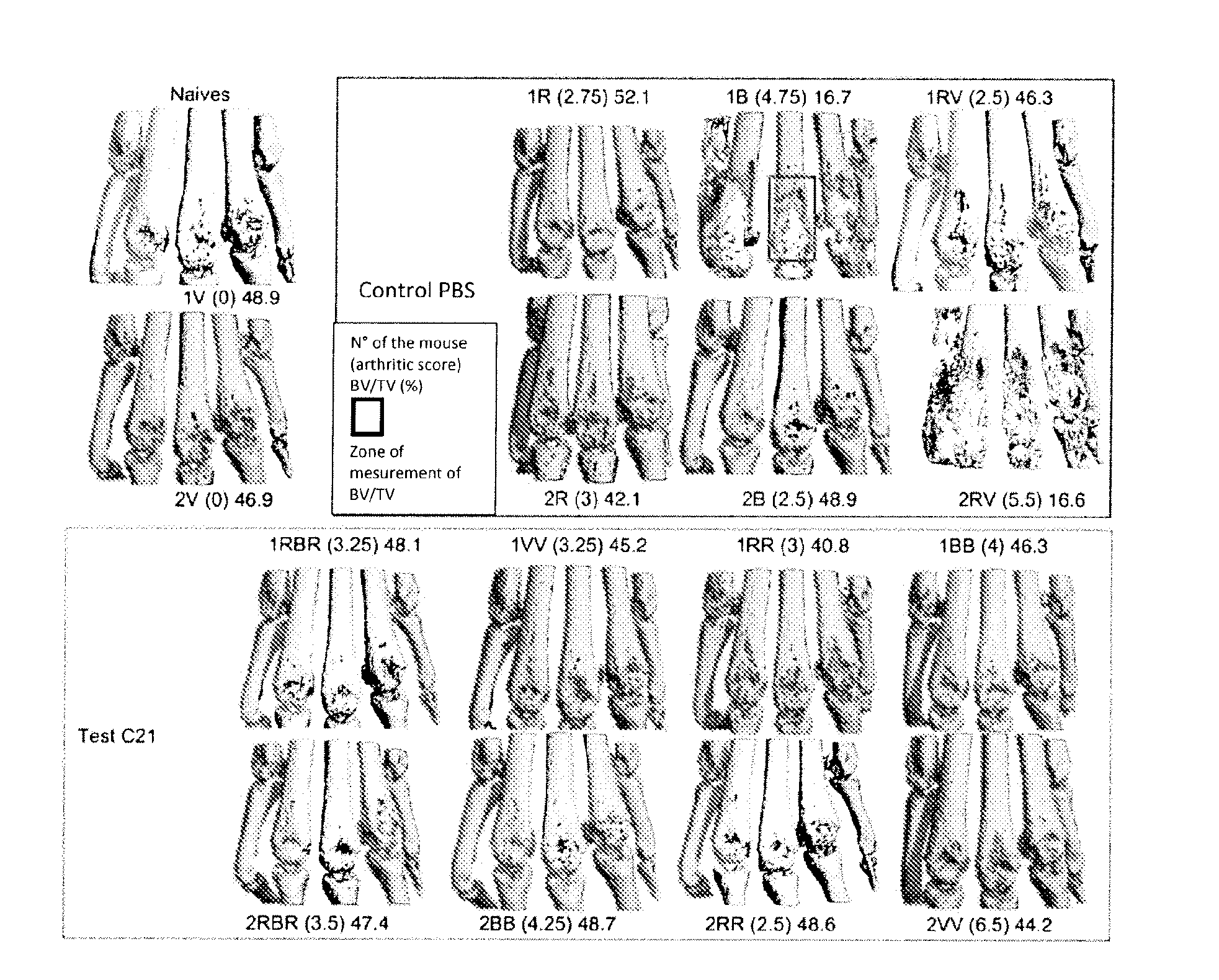 Compounds useful for treating and/or preventing disease-associated bone loss