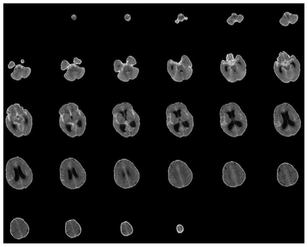 Brain image-based hemorrhagic area determination method and device, equipment and medium