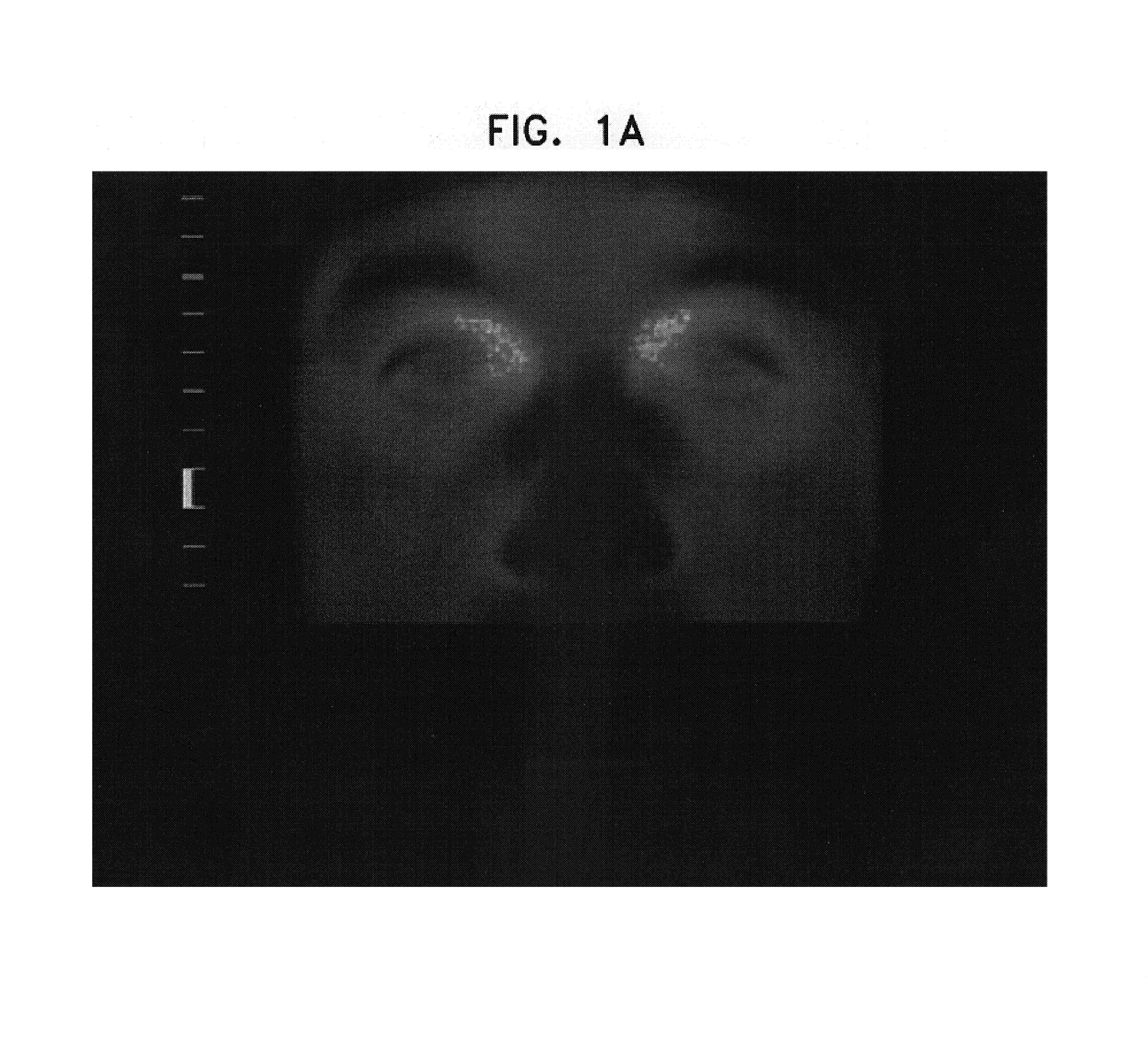 Apparatus and method for measuring biologic parameters