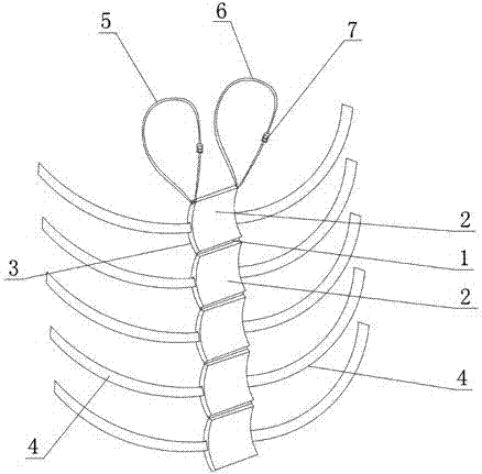 Reduction and fixation device used for lumbar vertebra fracture and provided with bundling bands