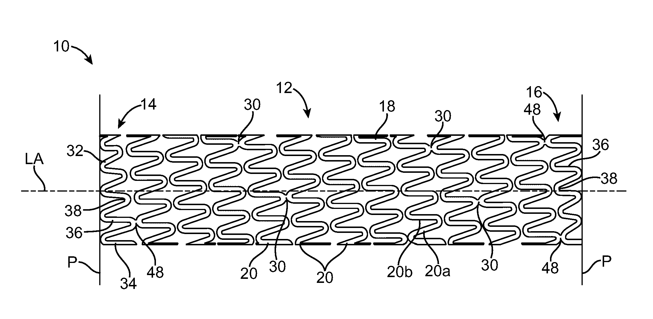 Stent With Improved Mechanical Properties