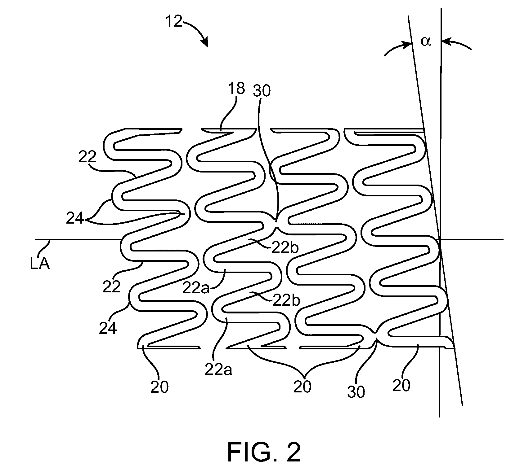 Stent With Improved Mechanical Properties