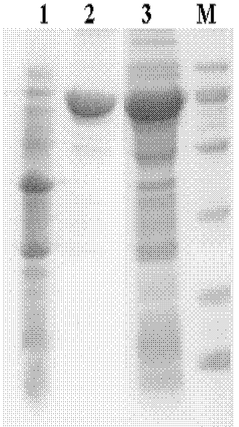 Method for preparing xylo-oligosaccharide and xylose with genetic engineering co-immobilized xylan degradation enzyme