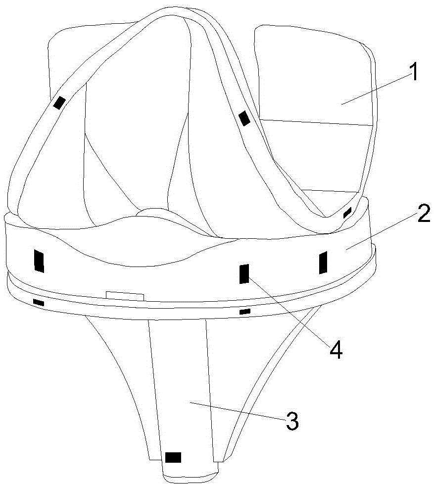 Artificial total knee joint prosthesis