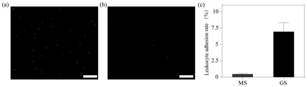 Cancer cell membrane embedded human bone micro-fluidic chip and preparation method and application thereof in separating circulating tumor cells