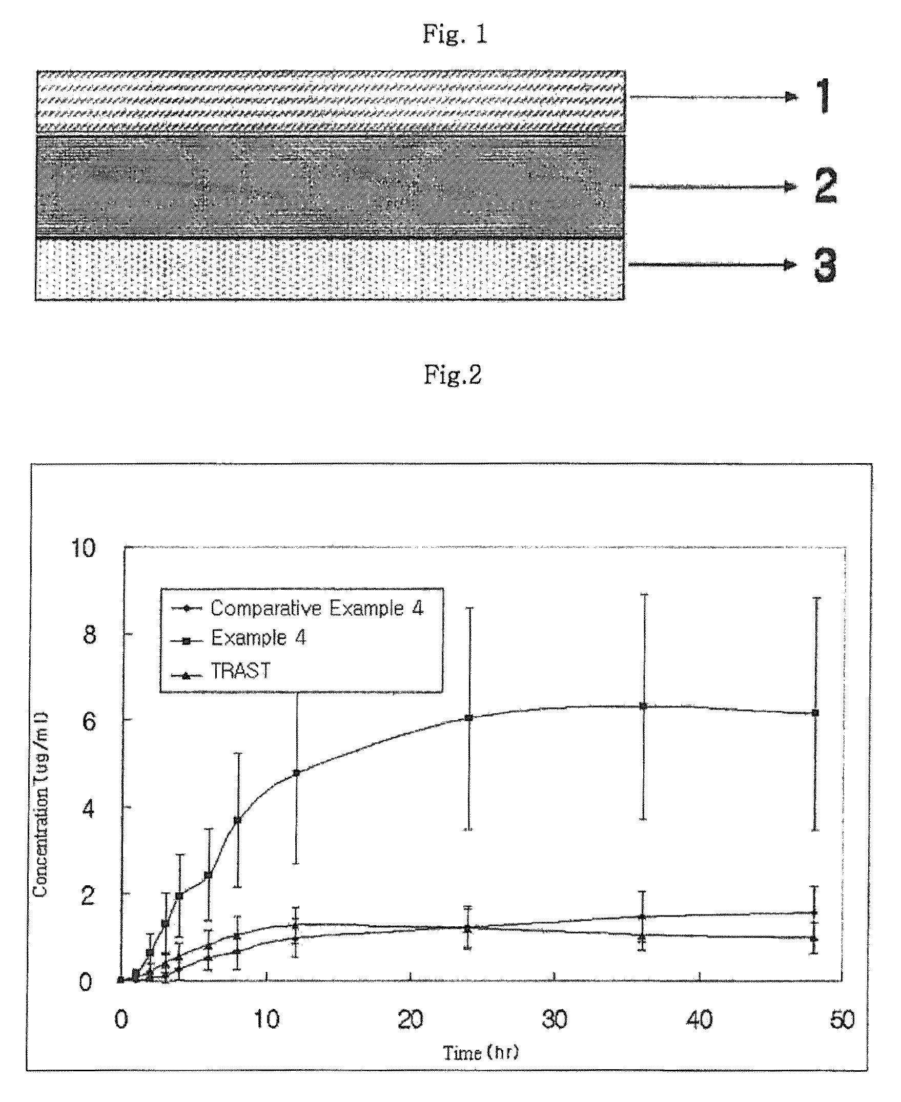 Preparation and composition of meloxicam transdermal drug delivery system