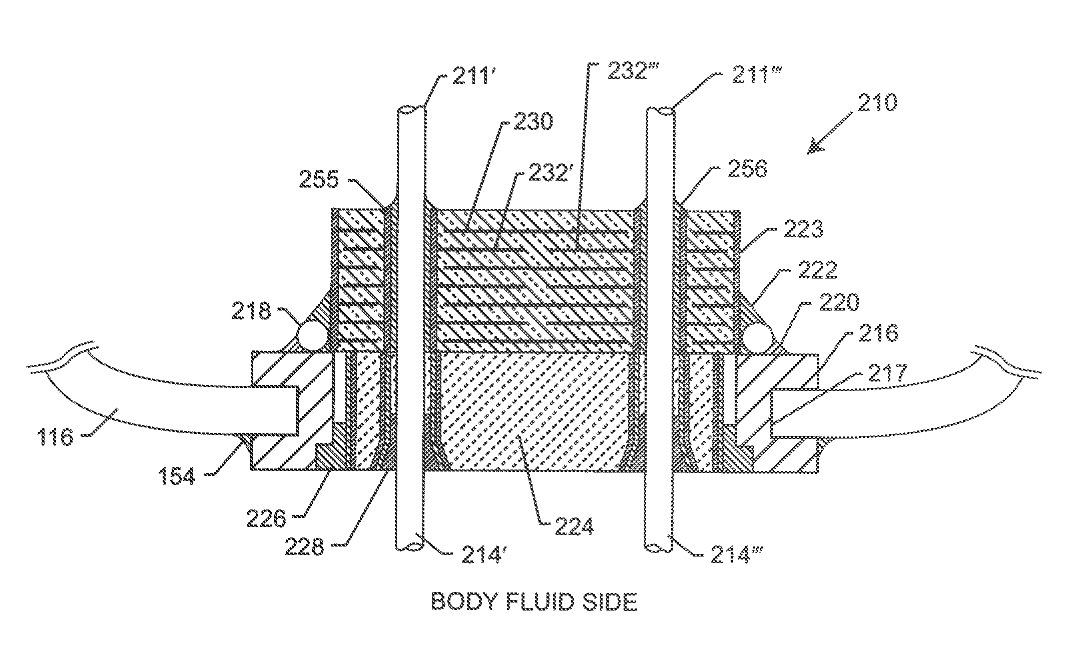 Low impedance oxide resistant grounded capacitor for an aimd