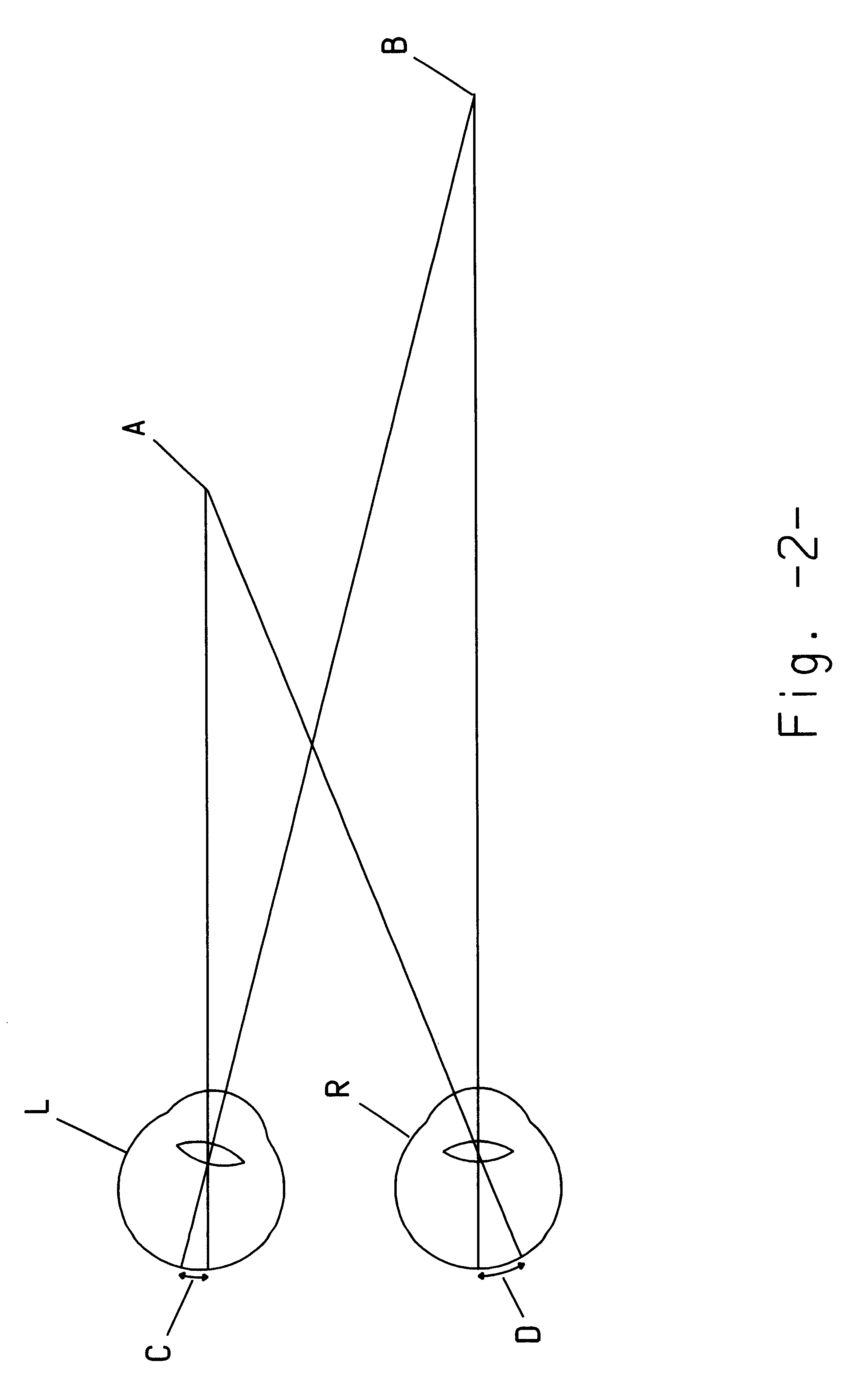 Method and apparatus for improved eye-hand co-ordination during videoscopic surgery