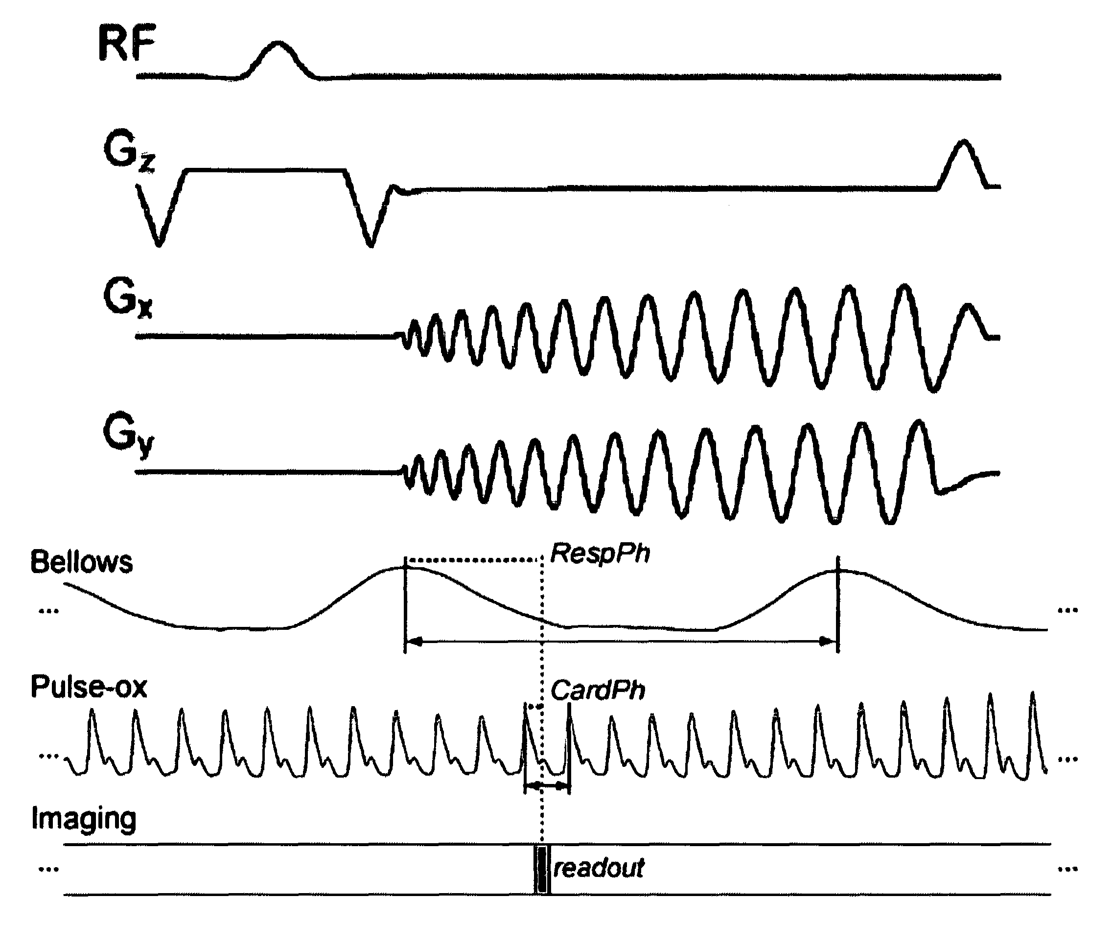 Multi-dimensional cardiac and respiratory imaging with MRI