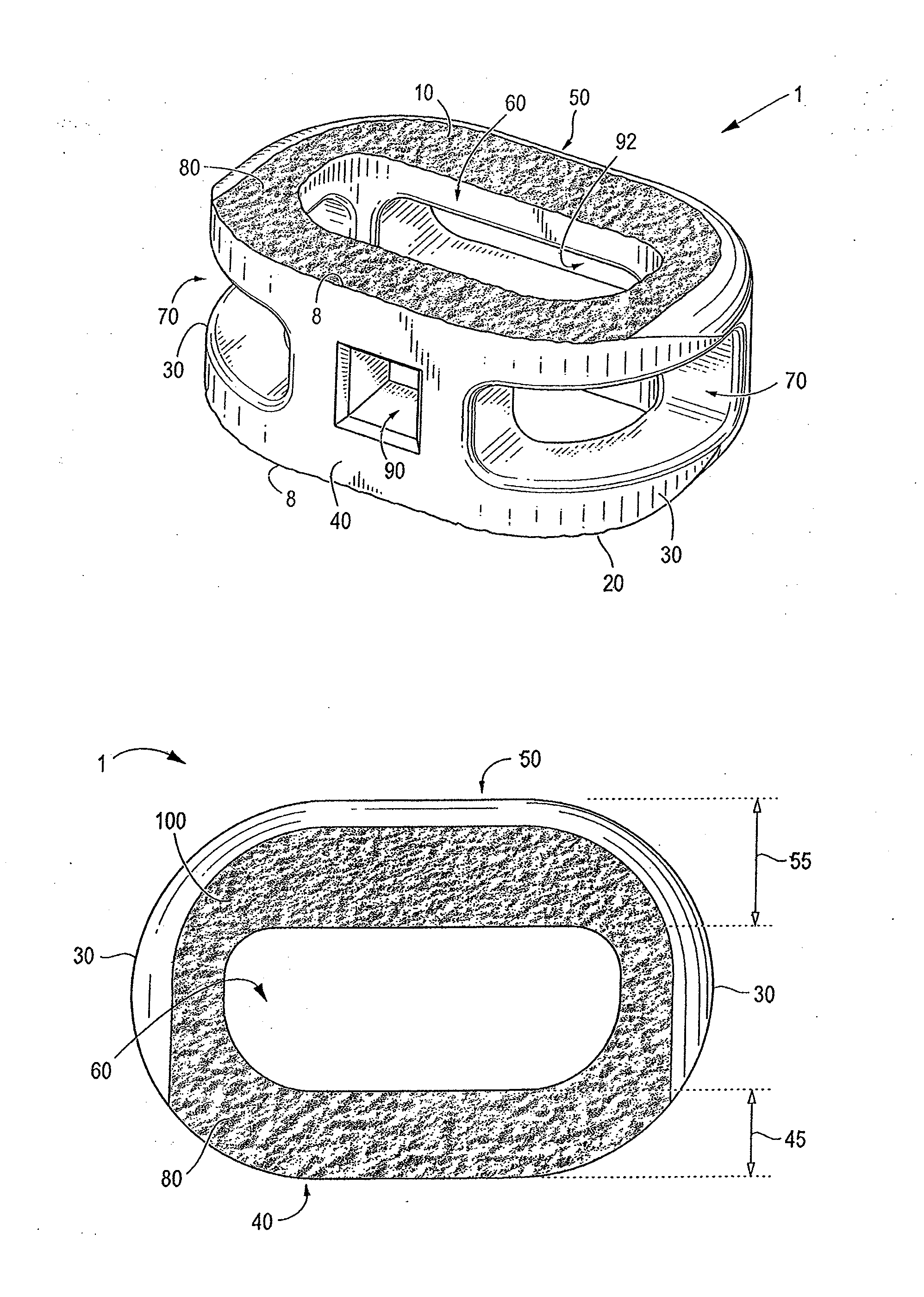 Endplate-preserving spinal implant with an integration plate having durable connectors