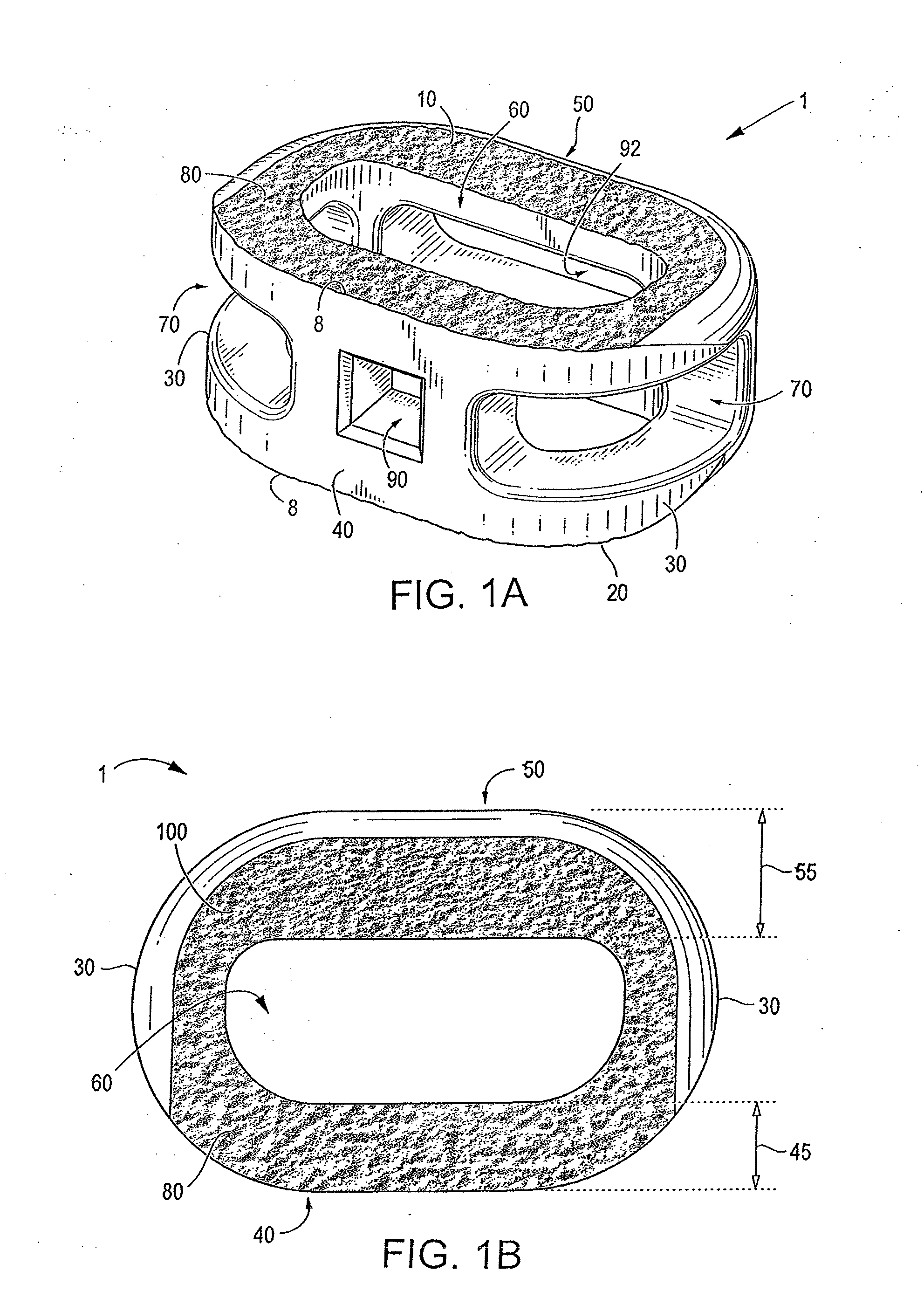 Endplate-preserving spinal implant with an integration plate having durable connectors