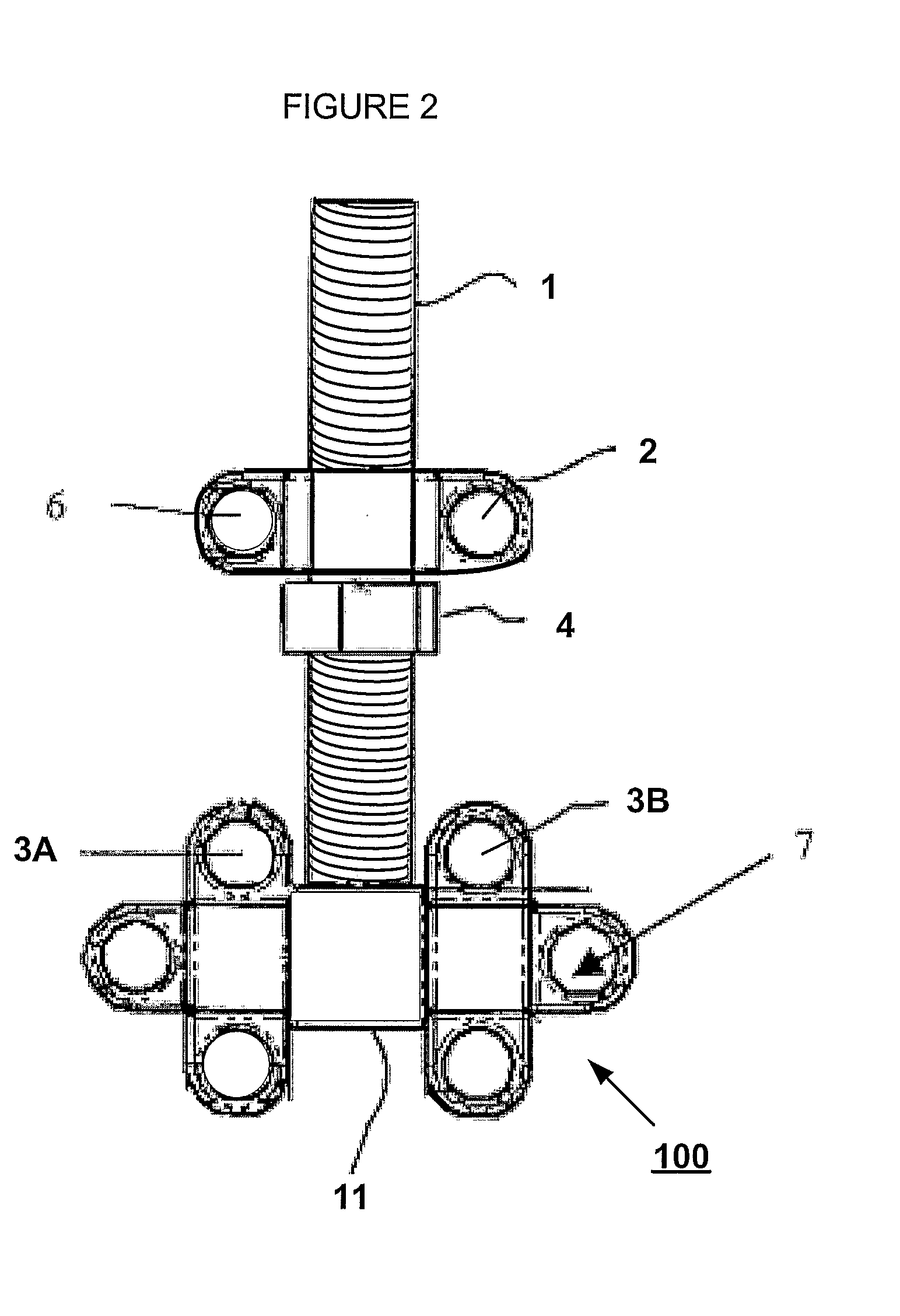 Intra-Oral Distraction Device