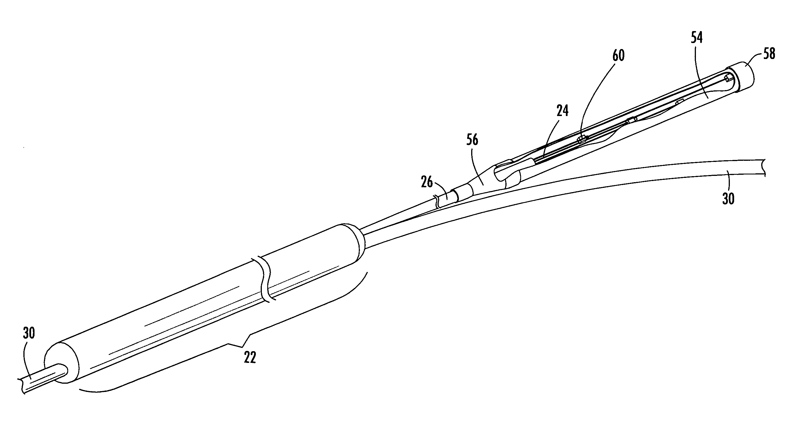 Distribution cable assembly having overmolded mid-span access location