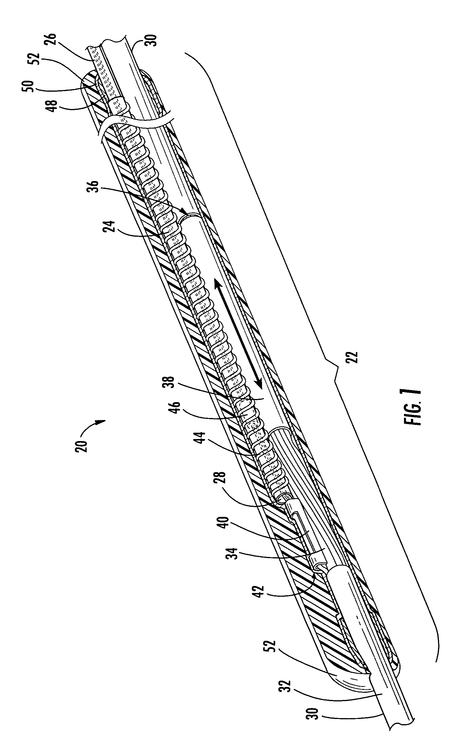 Distribution cable assembly having overmolded mid-span access location