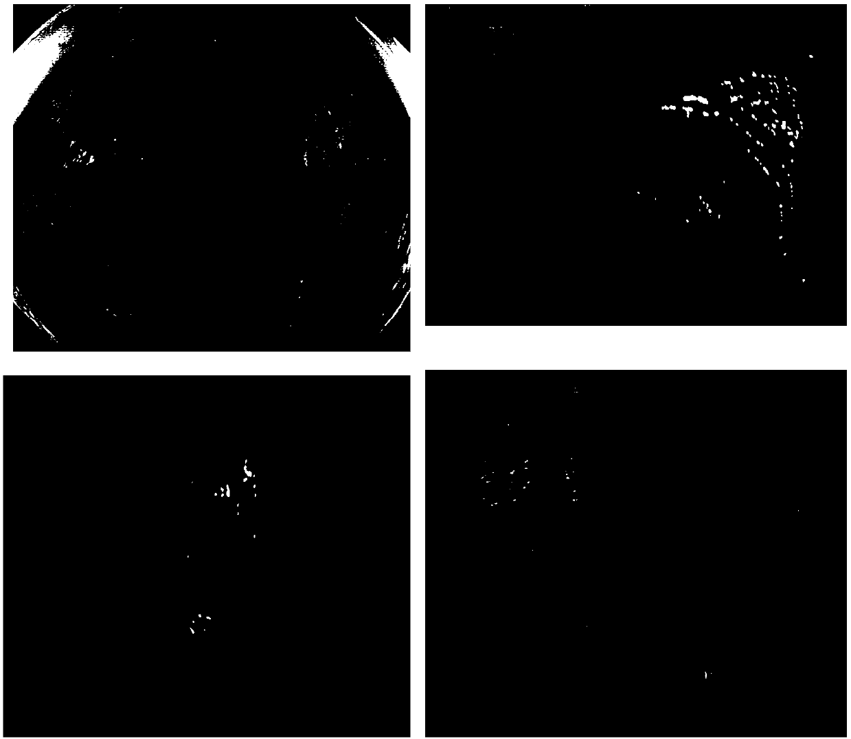 Chronic atrophic gastritis image recognition system, device and method