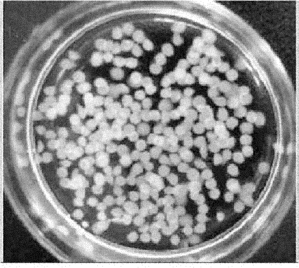 Preparation method of three-dimensional histioid cardiac muscular tissue for studying simulated microgravity effect