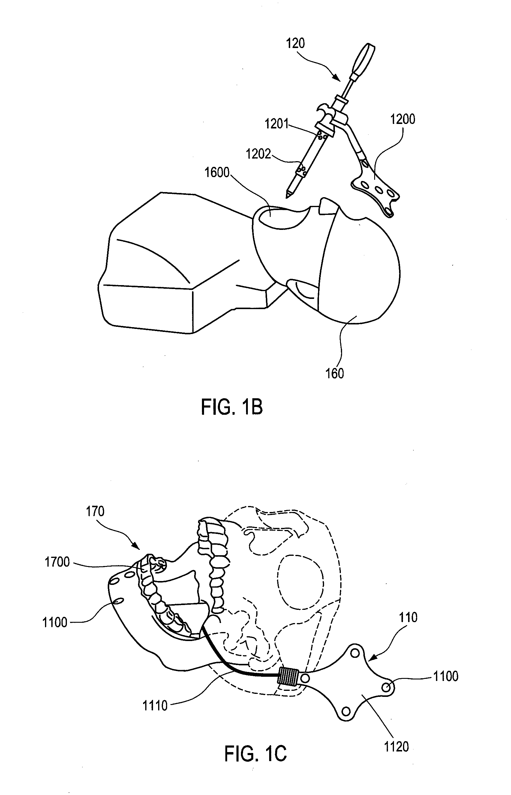 System and method for virtual reality simulation of local dental anesthesiological techniques and skills training