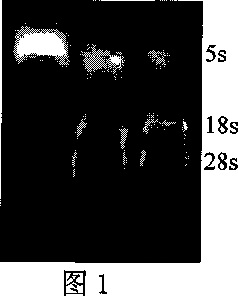 Extraction method for acute pancreatitis model animal pancreas tissue RNA