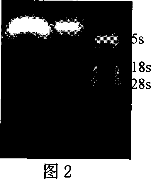 Extraction method for acute pancreatitis model animal pancreas tissue RNA