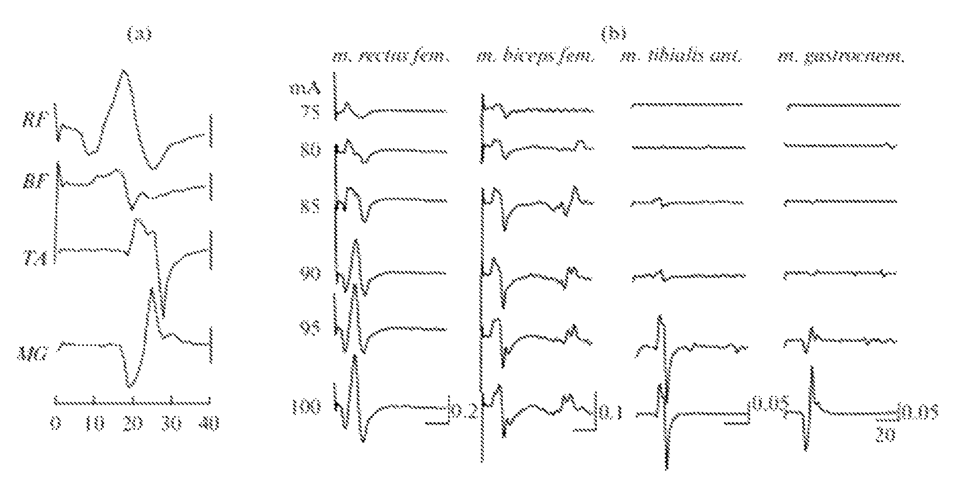 Transcutaneous spinal cord stimulation: noninvasive tool for activation of locomotor circuitry