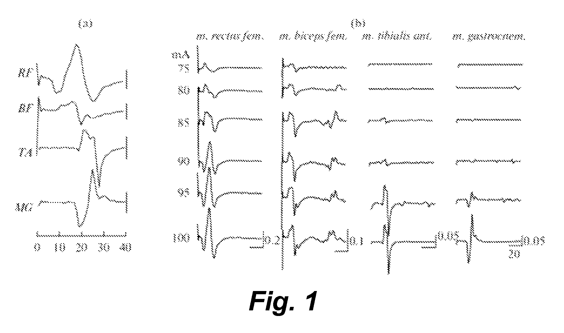 Transcutaneous spinal cord stimulation: noninvasive tool for activation of locomotor circuitry