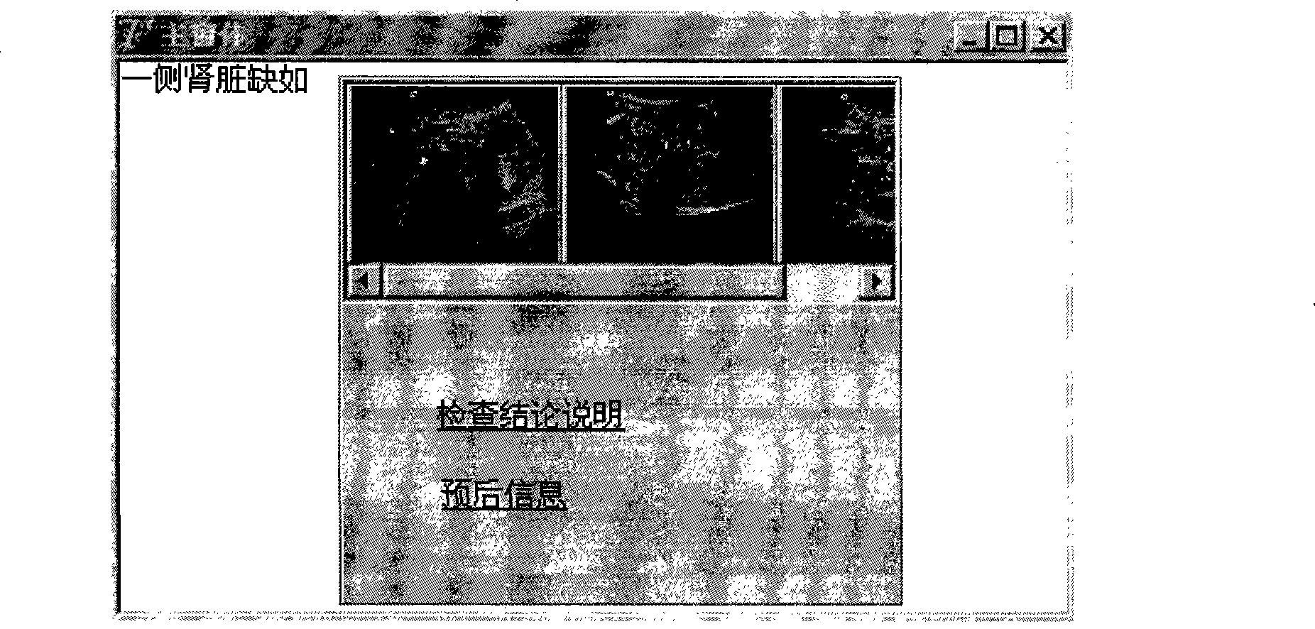 Method for displaying correlated information of fetus ultrasonic examination conclusion