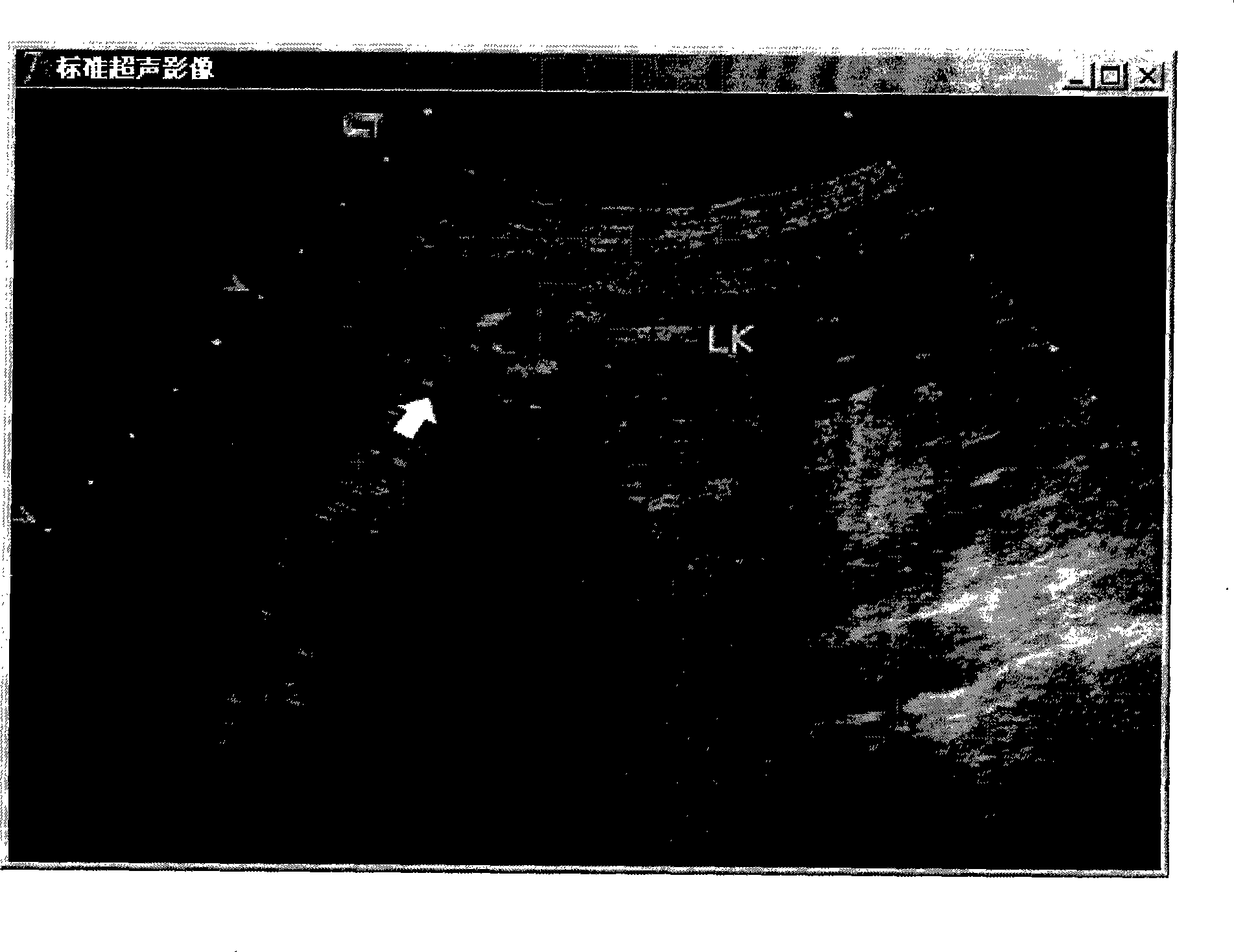 Method for displaying correlated information of fetus ultrasonic examination conclusion