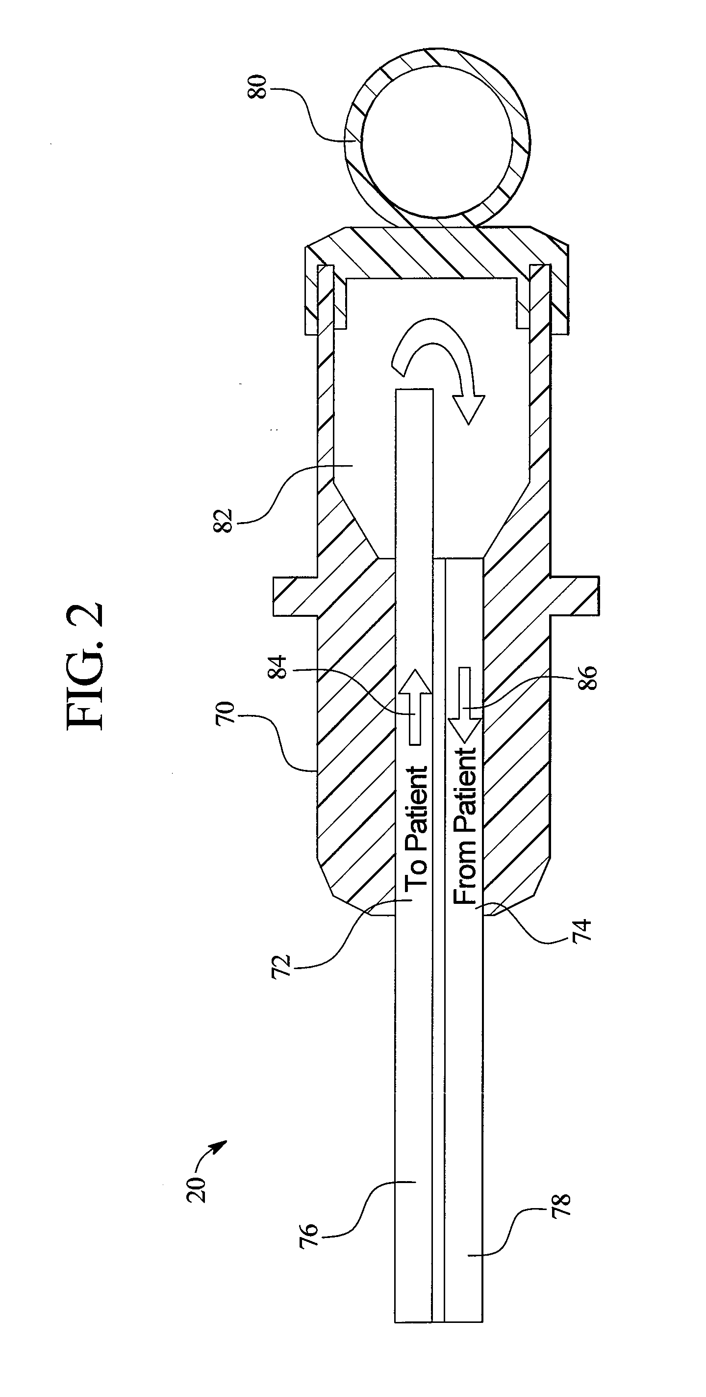 Weight/sensor-controlled sorbent system for hemodialysis