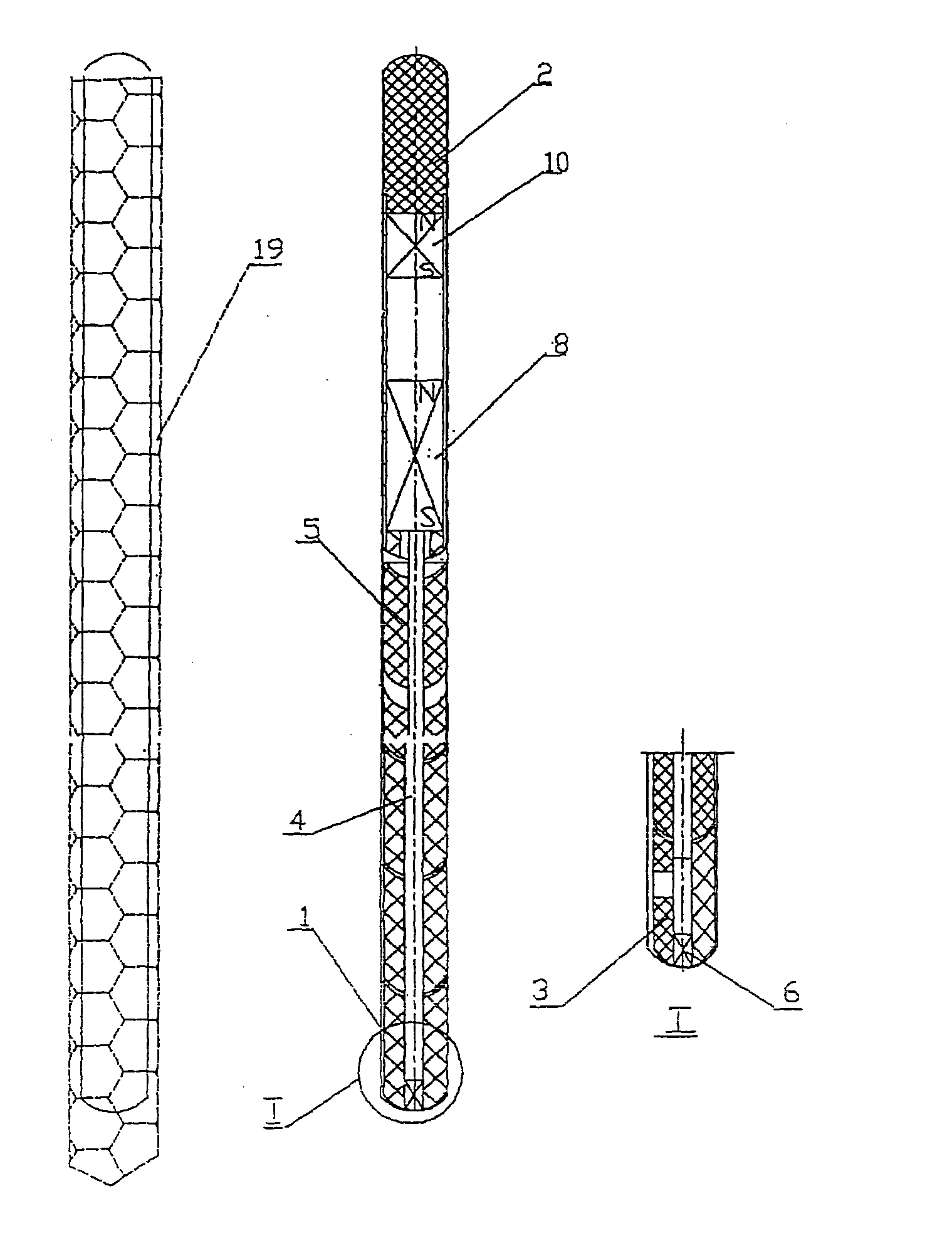 Penile prosthesis and method of implantation