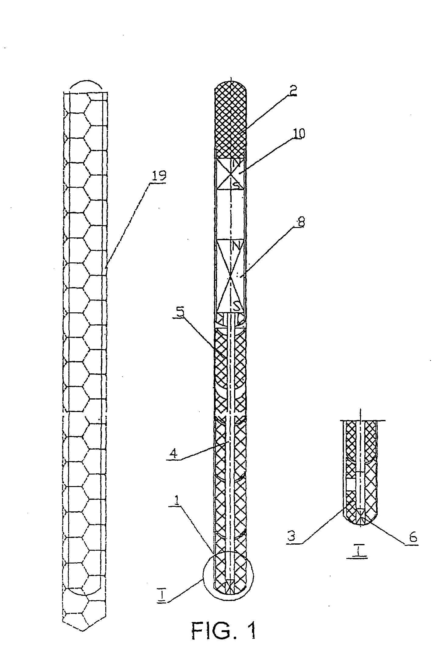 Penile prosthesis and method of implantation