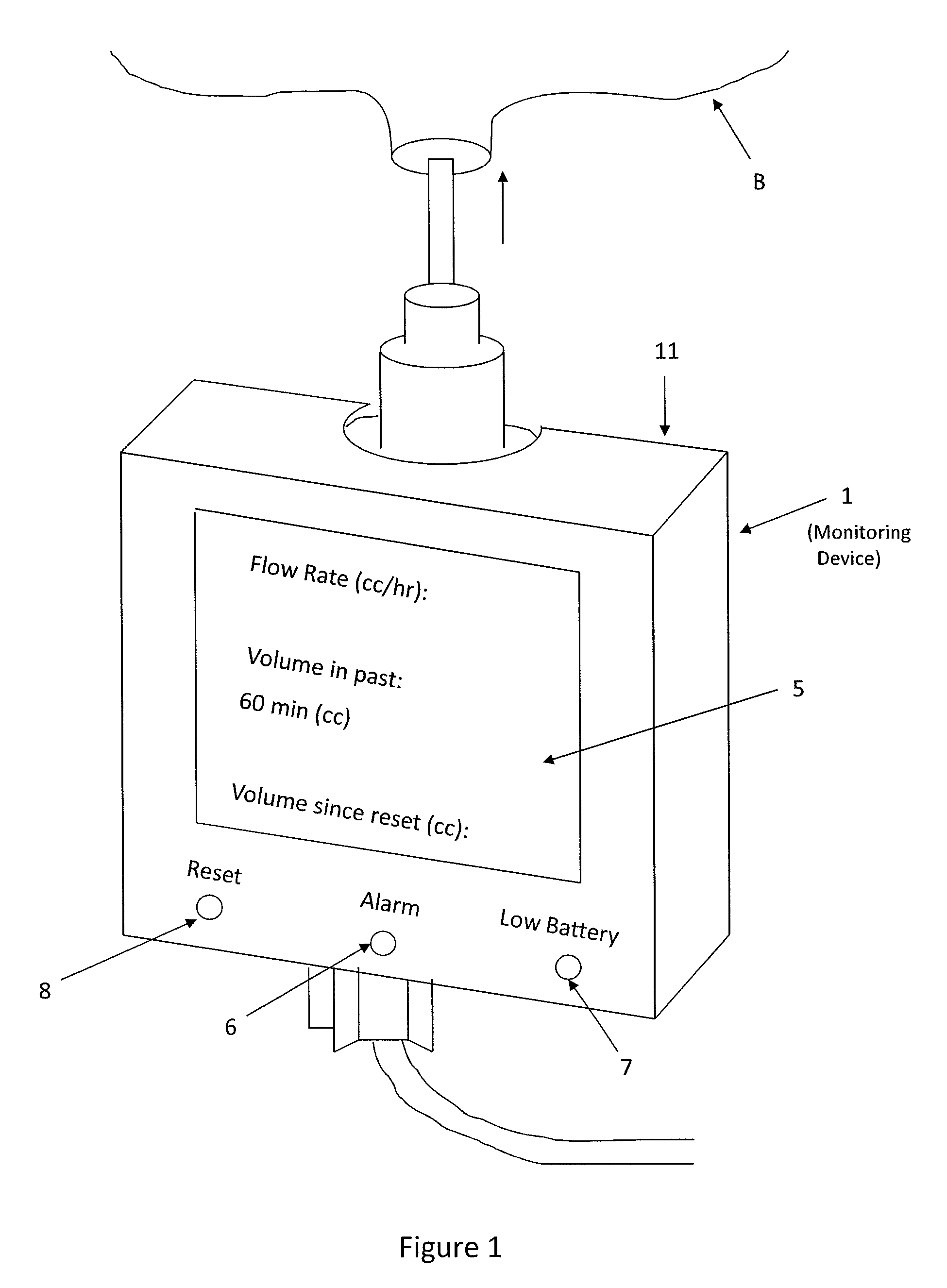 Automated intravenous monitoring device