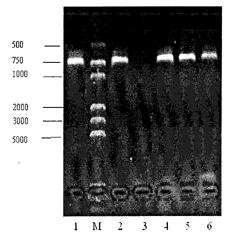 Streptococcus suis 7-type high-density fermentation medium and special strain